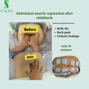 Manila Postpartum Recovery Market: Why More Mothers Choose Integrated Care Over Single-Service Providers