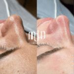 Why OFWs Choose Mold Manila for Safe, Time‑Efficient Aesthetic Care During Philippine Visits