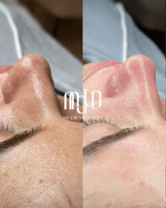 Why OFWs Choose Mold Manila for Safe, Time‑Efficient Aesthetic Care During Philippine Visits