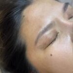 Mold Manila Spotlights Mold Plasma Lift: The Non-Surgical Alternative for Lids, Lines, and Sagging Skin